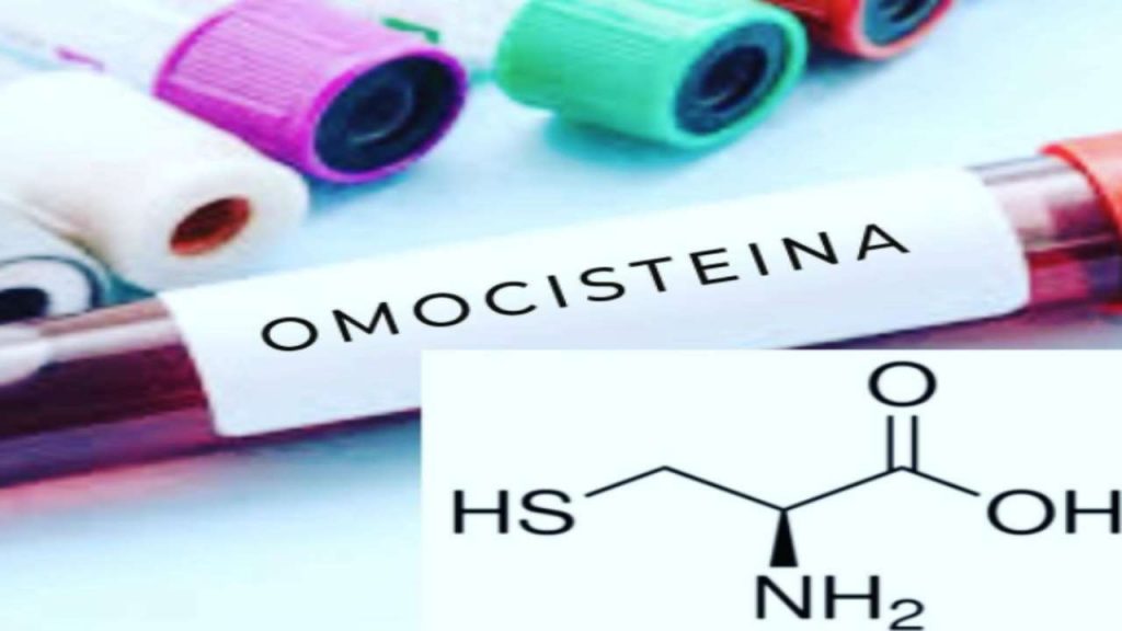 Omocisteina: Ecco Cosa Bisogna Fare Quando è Troppo Alta